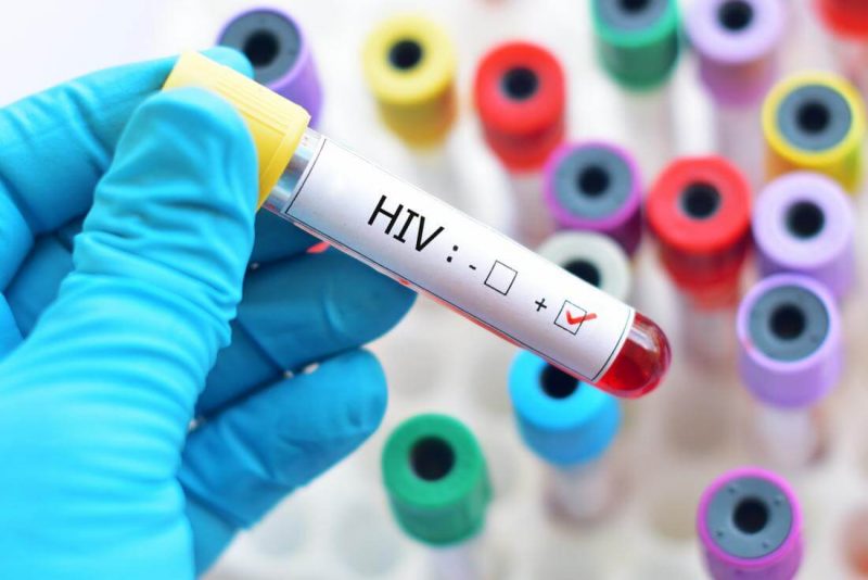 Human immunodeficiency virus (hiv)